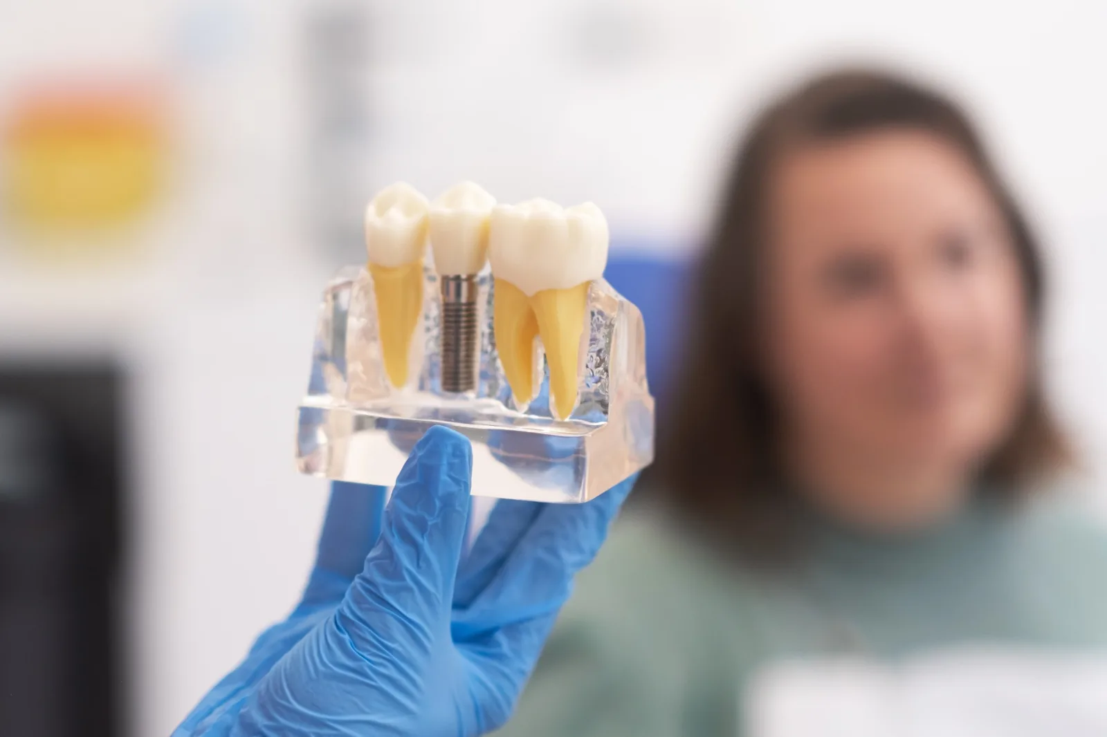 Are Dental Implants the Right Choice for You? A Comprehensive Guide from Your Woodland Dentist