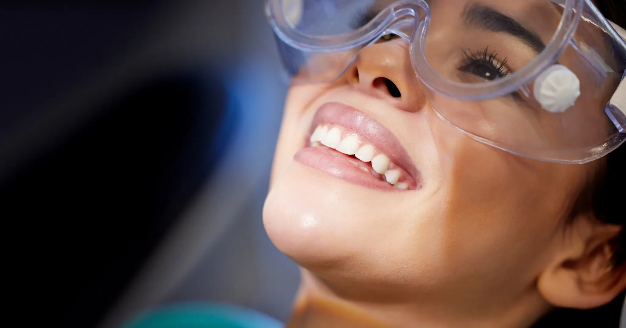 Patient smiling confidently after dental bonding at SpringLake Dental in Woodland