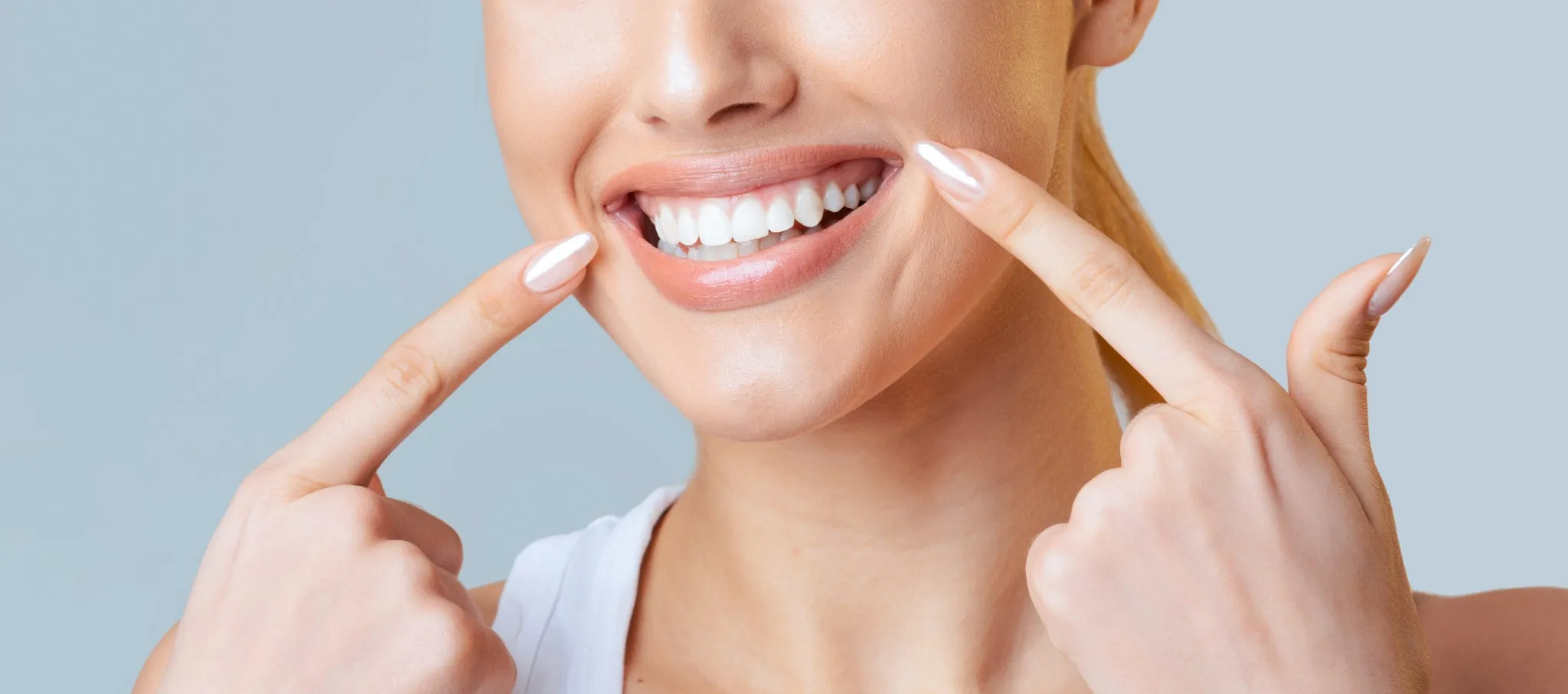 Before and after comparison of teeth whitening treatment - SpringLake Dental Woodland